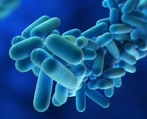 Legionella